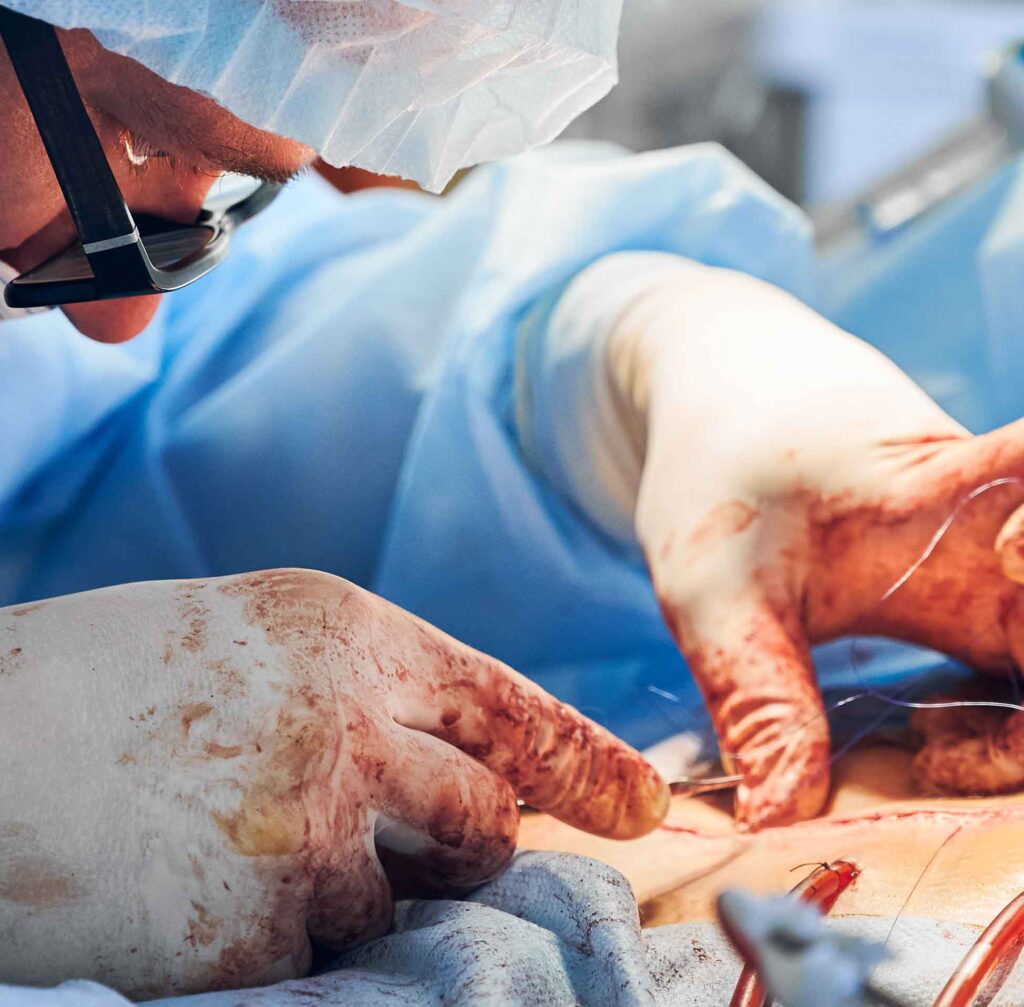 کارگاه روش ها و مدل های ارزیابی زخم برگزار شد